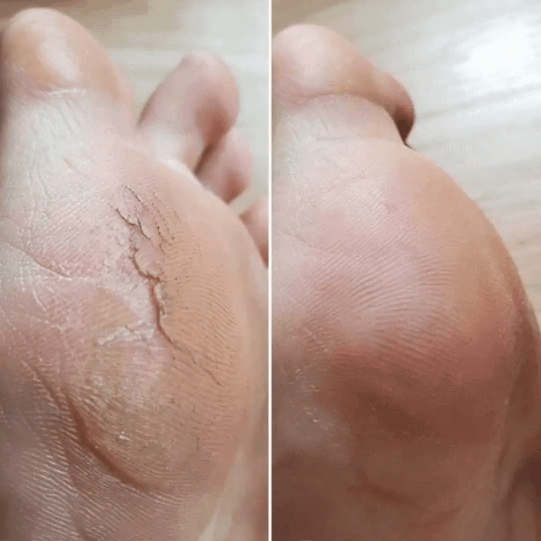 PediPure™ - Fresa Elettrica Professionale